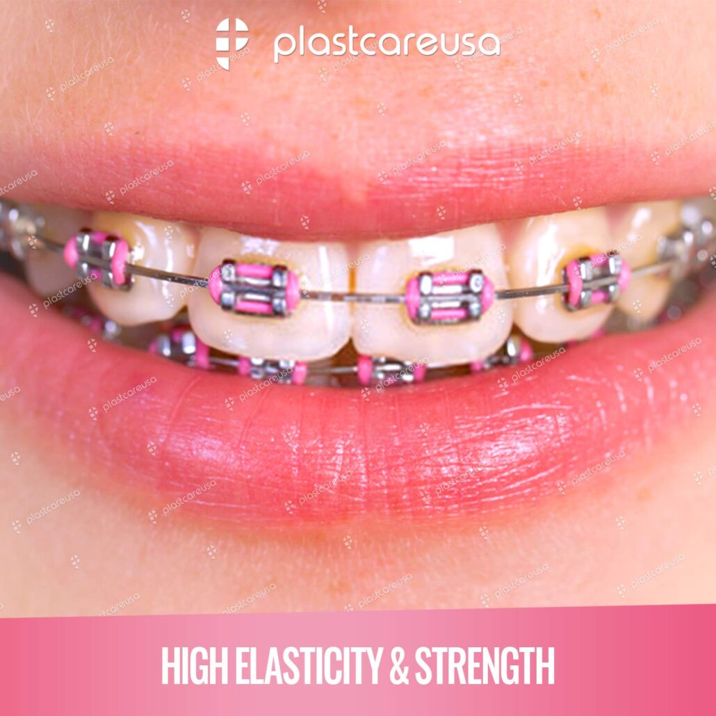 Orthodontic Ligature Gun & Band Combo