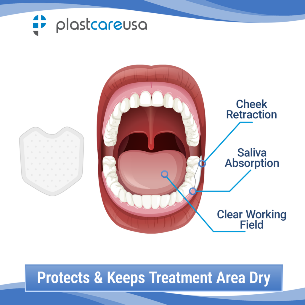 Small dental dry corners, saliva absorbent dry angles